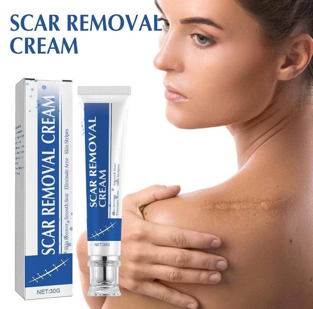 pid 67816 plastic scar removal cream white blue 3.jpg pid 67816 plastic scar removal cream white blue 3.jpg