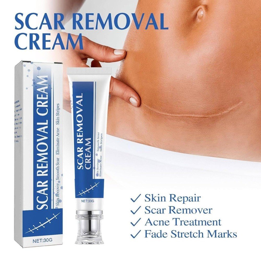 pid 67816 plastic scar removal cream white blue 4.jpg pid 67816 plastic scar removal cream white blue 4.jpg